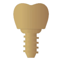 زراعة الاسنان Dental Implants